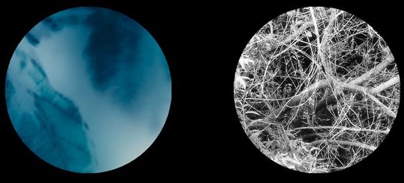 I-opener now tackles the subject of loneliness – in conversation with Oliver Juan