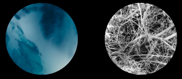 I-opener now tackles the subject of loneliness – in conversation with Oliver Juan